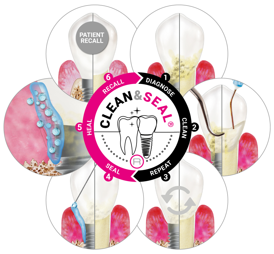 Clean_Seal_Flower_EN